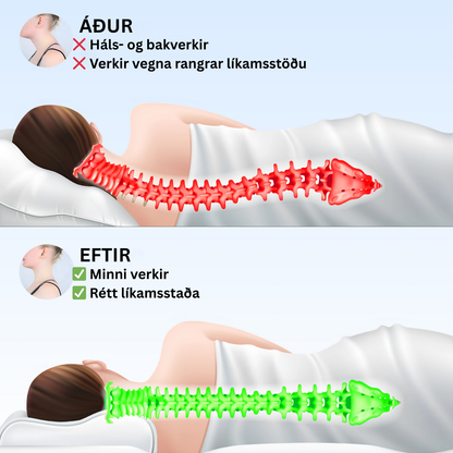 Lóna – Ergónómískur Verkjastillandi Koddi